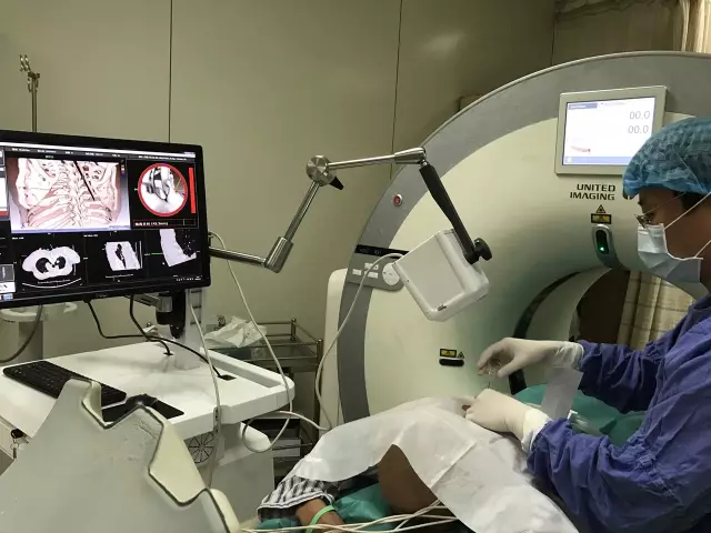 IQQA-Guide三維影像術中導航系統獲創新醫械特別審批，推動精準醫療新發展